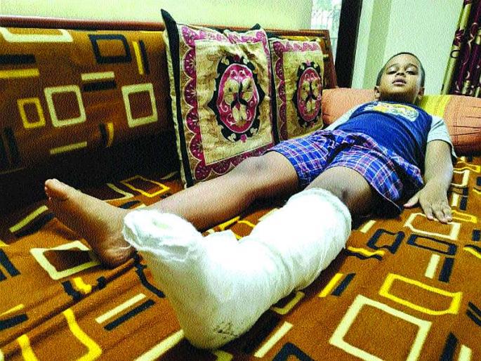 The student suffered serious injuries after falling on an iron gate | लोखंडी गेट पायावर पडल्याने विद्यार्थ्याला झाली गंभीर दुखापत The student suffered serious injuries after falling on an iron gate | लोखंडी गेट पायावर पडल्याने विद्यार्थ्याला झाली गंभीर दुखापत