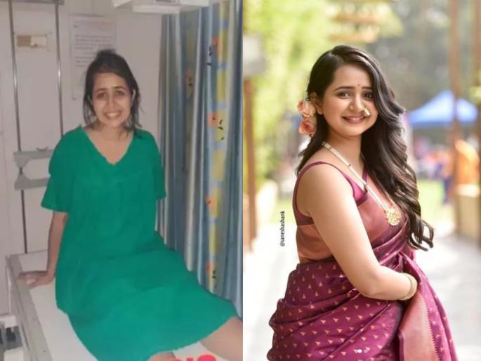 Gauri Kulkarni Accident: Aai Kuthe Kay Karte actress Gauri Kulkarni leg injured after scooter Accident few days back | Gauri Kulkarni Accident: आई कुठे काय करते फेम गौरीच्या स्कुटरला अपघात; पायाला गंभीर दुखापत Gauri Kulkarni Accident: Aai Kuthe Kay Karte actress Gauri Kulkarni leg injured after scooter Accident few days back | Gauri Kulkarni Accident: आई कुठे काय करते फेम गौरीच्या स्कुटरला अपघात; पायाला गंभीर दुखापत