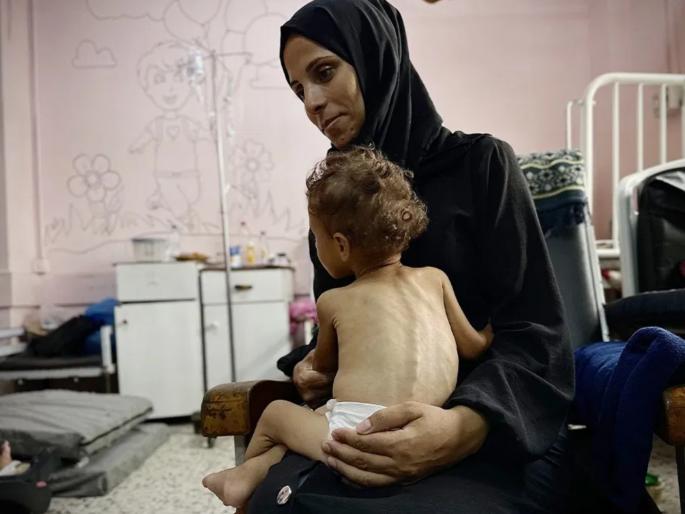 Why is this dangerous disease spreading so rapidly in Gaza? Treatment is impossible; Doctors' headaches increase! | गाझामध्ये 'हा' धोकादायक आजार का पसरतोय वेगाने? उपचारही झालेत अशक्य; डॉक्टरांची डोकेदुखी वाढली!