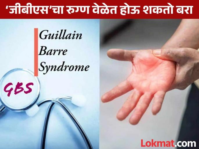 The right treatment is the right dose; GBS patient can recover in time | योग्य उपचार हीच मात्रा; ‘जीबीएस’चा रुग्ण वेळेत होऊ शकतो बरा The right treatment is the right dose; GBS patient can recover in time | योग्य उपचार हीच मात्रा; ‘जीबीएस’चा रुग्ण वेळेत होऊ शकतो बरा