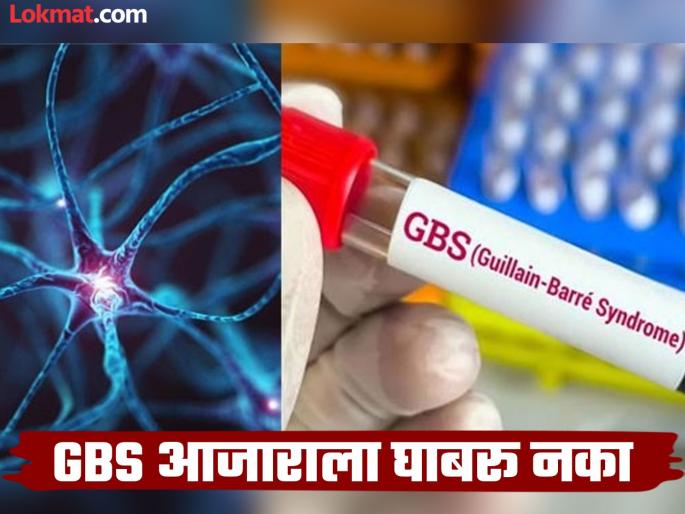 Good news 5 patients treated in ICU in Sassoon are free from GBS; discharged. | आनंदाची बातमी..! ससूनमध्ये आयसीयूत उपचार घेतलेले ५ रुग्ण GBS मुक्त; डिस्चार्जही मिळाला Good news 5 patients treated in ICU in Sassoon are free from GBS; discharged. | आनंदाची बातमी..! ससूनमध्ये आयसीयूत उपचार घेतलेले ५ रुग्ण GBS मुक्त; डिस्चार्जही मिळाला