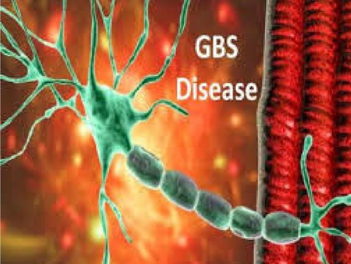 Elderly man from Gadmudshingi dies of GB syndrome in Kolhapur both on ventilator | कोल्हापुरात जीबी सिंड्रोमने गडमुडशिंगीच्या वृद्धाचा मृत्यू, दोघे व्हेंटिलेटरवर; मृतांची एकूण संख्या किती.. वाचा Elderly man from Gadmudshingi dies of GB syndrome in Kolhapur both on ventilator | कोल्हापुरात जीबी सिंड्रोमने गडमुडशिंगीच्या वृद्धाचा मृत्यू, दोघे व्हेंटिलेटरवर; मृतांची एकूण संख्या किती.. वाचा