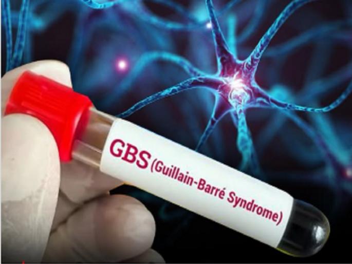 First victim of GBS syndrome in Kolhapur district | GBS Outbreak: कोल्हापूर जिल्ह्यात जीबीएस सिंड्रोमचा पहिला बळी  First victim of GBS syndrome in Kolhapur district | GBS Outbreak: कोल्हापूर जिल्ह्यात जीबीएस सिंड्रोमचा पहिला बळी