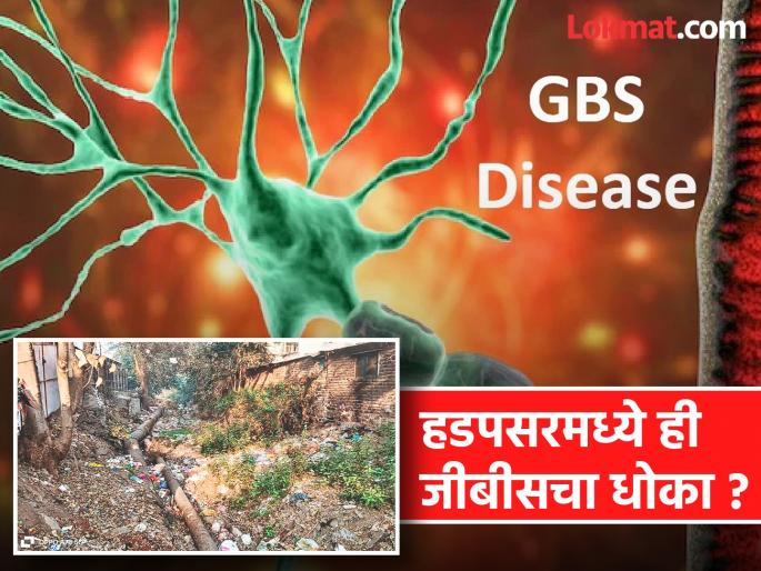 Is this a GBS threat in Hadapsar? Inexcusable neglect of Hadapsar Regional Office, Health Department, Solid Waste Department | हडपसरमध्ये ही जीबीसचा धोका ? क्षेत्रीय कार्यालय,आरोग्य विभाग,घनकचरा विभागाचे अक्षम्य दुर्लक्ष Is this a GBS threat in Hadapsar? Inexcusable neglect of Hadapsar Regional Office, Health Department, Solid Waste Department | हडपसरमध्ये ही जीबीसचा धोका ? क्षेत्रीय कार्यालय,आरोग्य विभाग,घनकचरा विभागाचे अक्षम्य दुर्लक्ष