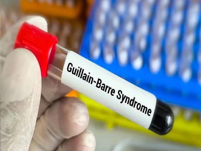 Dose of half a lakh for GB syndrome free injections given to 22 patients from CPR in Kolhapur so far | जीबी सिंड्रोम'साठी सव्वा लाखाचा डोस, कोल्हापुरातील सीपीआरमधून आतापर्यंत २२ रुग्णांना दिली मोफत इंजेक्शन्स Dose of half a lakh for GB syndrome free injections given to 22 patients from CPR in Kolhapur so far | जीबी सिंड्रोम'साठी सव्वा लाखाचा डोस, कोल्हापुरातील सीपीआरमधून आतापर्यंत २२ रुग्णांना दिली मोफत इंजेक्शन्स