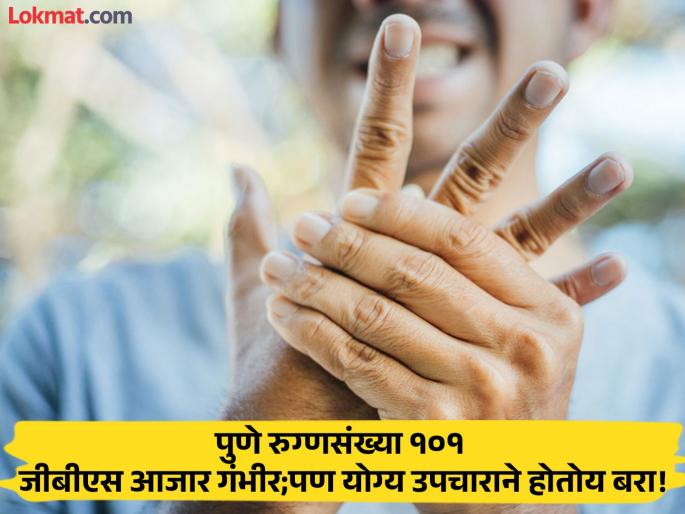 Number of GBS patients in Pune rises to 101; 16 patients on ventilator, one death so far | GBS Outbreak: पुण्यात जीबीएस रुग्णांची संख्या १०१ वर; १६ रुग्ण व्हेंटिलेटरवर, आतापर्यंत एकाचा मृत्यू Number of GBS patients in Pune rises to 101; 16 patients on ventilator, one death so far | GBS Outbreak: पुण्यात जीबीएस रुग्णांची संख्या १०१ वर; १६ रुग्ण व्हेंटिलेटरवर, आतापर्यंत एकाचा मृत्यू