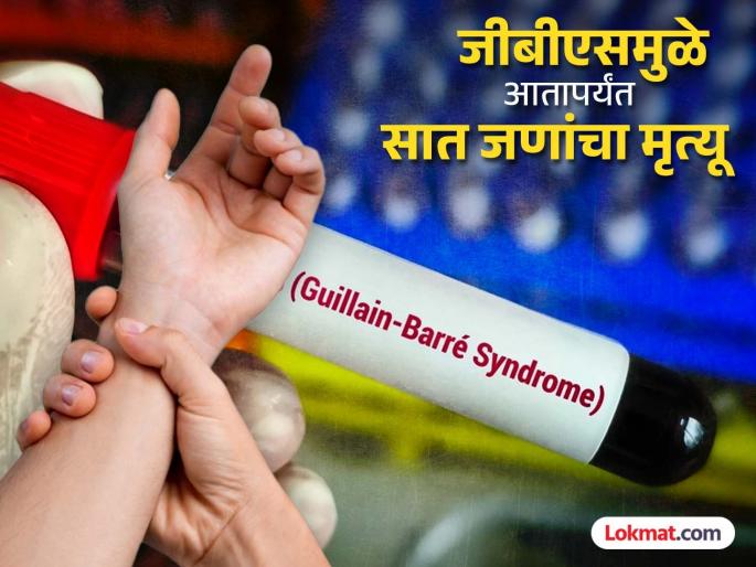 GBS: Another death due to GBS in Pune, 48 patients in ICU, 21 on ventilator | GBS: पुण्यात जीबीएसमुळे आणखी एकाचा मृत्यू, ४८ रुग्ण आयसीयूमध्ये, २१ व्हेटिंलेटरवर GBS: Another death due to GBS in Pune, 48 patients in ICU, 21 on ventilator | GBS: पुण्यात जीबीएसमुळे आणखी एकाचा मृत्यू, ४८ रुग्ण आयसीयूमध्ये, २१ व्हेटिंलेटरवर