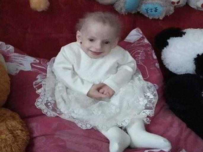 Girl aged 8 dies of old age in ukraine after genetic disease | धक्कादायक! ८ वर्षातच जगली ८० वर्षाचं आयुष्य, बालपणीच वृद्ध होऊन मुलीचा मृत्यू! Girl aged 8 dies of old age in ukraine after genetic disease | धक्कादायक! ८ वर्षातच जगली ८० वर्षाचं आयुष्य, बालपणीच वृद्ध होऊन मुलीचा मृत्यू!