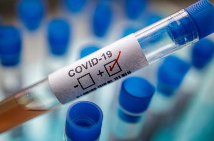 A young woman from Mumbai in Wardha district tested positive for corona | Corona Virus in Wardha; वर्धा जिल्ह्यात मुंबईहून आलेली तरूणी निघाली कोरोना पॉझिटिव्ह