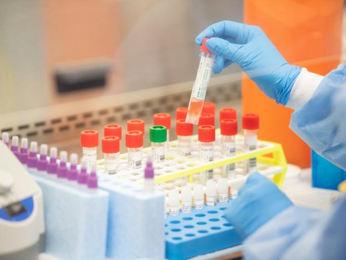 The good news; Now the test of 'Corona' will be done in a private laboratory in Solapur | चांगली बातमी; आता सोलापुरातील खासगी प्रयोगशाळेत होणार ‘कोरोना’ ची टेस्ट The good news; Now the test of 'Corona' will be done in a private laboratory in Solapur | चांगली बातमी; आता सोलापुरातील खासगी प्रयोगशाळेत होणार ‘कोरोना’ ची टेस्ट