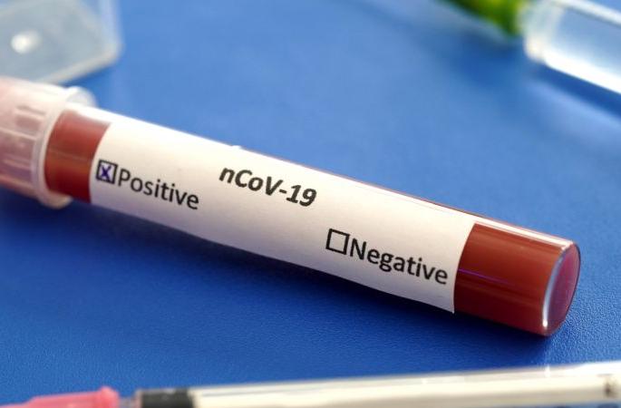 In Nagpur, five more positive total 148 | नागपुरात पाच अजून पॉझिटिव्ह; एकूण १४८ In Nagpur, five more positive total 148 | नागपुरात पाच अजून पॉझिटिव्ह; एकूण १४८