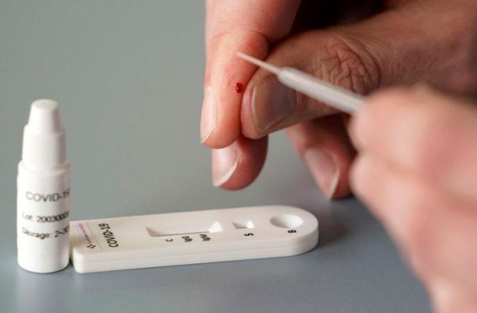 One hundred samples in Gondia district are negative | Corona Virus in Gondia; गोंदिया जिल्ह्यातील शंभर नमुने निगेटिव्ह