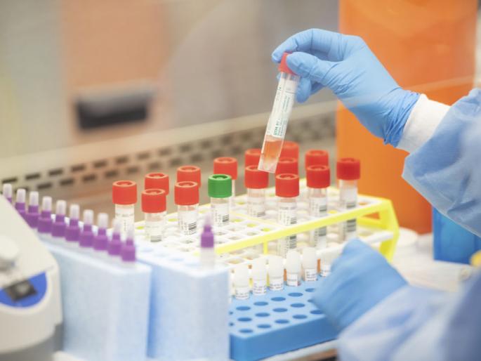 Now the report of Corona test in Solapur will be available in two hours | आता सोलापुरातील कोरोना टेस्टचा अहवाल दोन तासात मिळणार Now the report of Corona test in Solapur will be available in two hours | आता सोलापुरातील कोरोना टेस्टचा अहवाल दोन तासात मिळणार