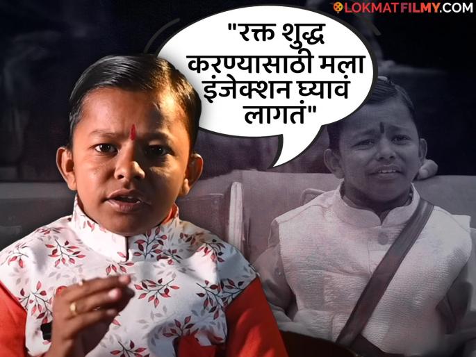 bigg boss marathi fame ghanshyam darode revelation about her health issues say he was suffer from liver and lungs problem | "किडनीचा त्रास अन् फुफ्फुसांना सूज..." घनश्याम दरवडेनं 'त्या' आजारपणाबद्दल पहिल्यांदाच सांगितलं! म्हणाला... bigg boss marathi fame ghanshyam darode revelation about her health issues say he was suffer from liver and lungs problem | "किडनीचा त्रास अन् फुफ्फुसांना सूज..." घनश्याम दरवडेनं 'त्या' आजारपणाबद्दल पहिल्यांदाच सांगितलं! म्हणाला...