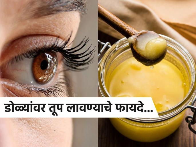 Ayurveda doctor told how to apply ghee on eyes and its benefits | आयुर्वेद डॉक्टरांनी सांगितले डोळ्यांवर तूप लावण्याचे फायदे, वाचाल तर रोज लावाल..