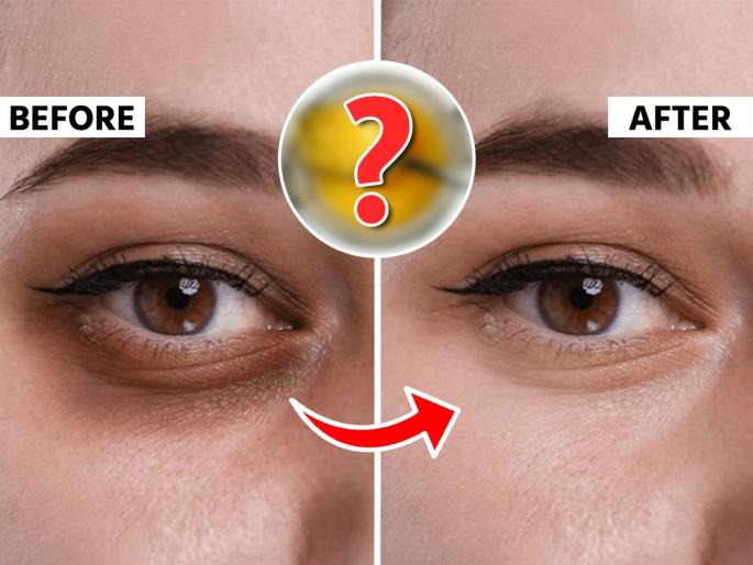 Best Ways To Use Ghee For Dark Circles How To Use DESI GHEE for Dark Circles Use ghee to reduce dark circles | स्वयंपाक घरातील 'या' पदार्थाने करा मसाज! डार्क सर्कल्स गायब - डोळे दिसतील सुंदर,आकर्षक...