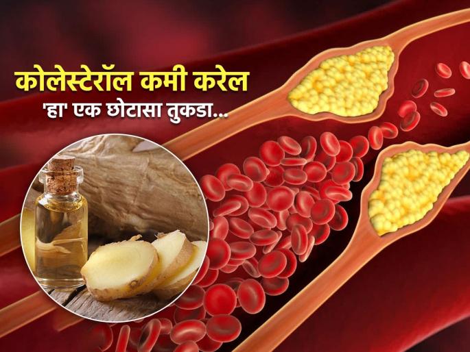 Dr Saleem Zaidi told best way to eat raw ginger directly to prevent heart attack | कोलेस्टेरॉल घरीच कमी करण्याचा बेस्ट उपाय, फक्त रोज खा 'या' मसाल्याचा एक कच्चा तुकडा!