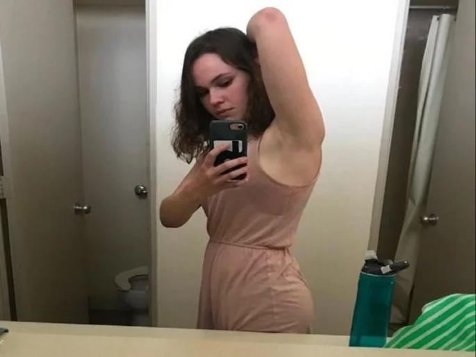 Girl sweats more than 10 times as much as a normal person | 'या' तरूणीचं शरीर काही मिनिटातच आंघोळ केल्यासारखं भीजतं, वापरावं लागतं इलेक्ट्रॉनिक डिव्हाइस! Girl sweats more than 10 times as much as a normal person | 'या' तरूणीचं शरीर काही मिनिटातच आंघोळ केल्यासारखं भीजतं, वापरावं लागतं इलेक्ट्रॉनिक डिव्हाइस!