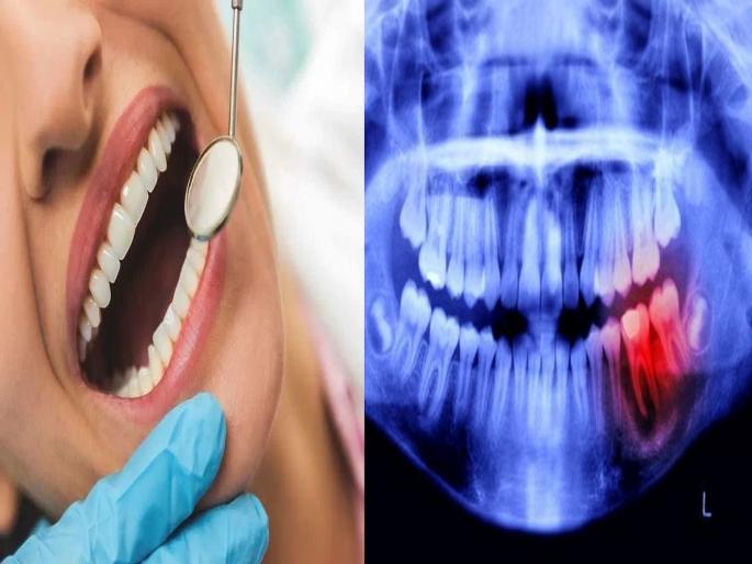 when you eat sweets my teeth hurting reasons, know oral health care tips | गोड, थंड खाल्ल्यावर तुम्हालाही दातात वेदना होतात? मग 'या' सोप्या उपायांनी कायमचा मिळेल आराम when you eat sweets my teeth hurting reasons, know oral health care tips | गोड, थंड खाल्ल्यावर तुम्हालाही दातात वेदना होतात? मग 'या' सोप्या उपायांनी कायमचा मिळेल आराम
