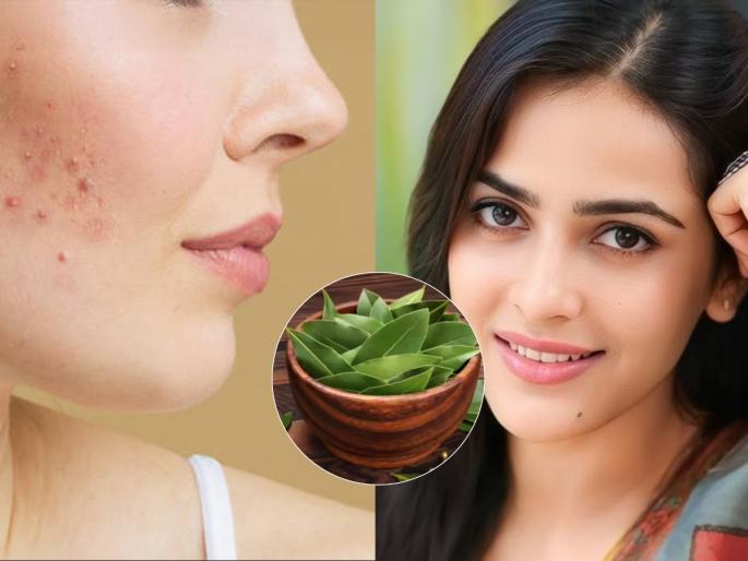 how to reduce pimples naturally at Home kitchen ingredients for glowing skin best natural remedies for acne marks | महागड्या पार्लरचा खर्च नको! स्वयंपाकघरातील २ पदार्थ चेहरा करेल ग्लो - पिंपल्स- फोडांचे डाग होतील कमी