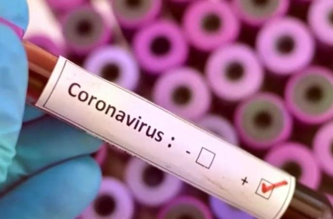 Corona Virus in Nagpur: 982 new positive, 38 patients die in Nagpur | CoronaVirus in Nagpur : नागपुरात ९८२ नवीन पॉझिटिव्ह, ३८ रुग्णांचा मृत्यू Corona Virus in Nagpur: 982 new positive, 38 patients die in Nagpur | CoronaVirus in Nagpur : नागपुरात ९८२ नवीन पॉझिटिव्ह, ३८ रुग्णांचा मृत्यू