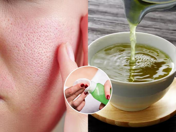 green tea for open pores how to use green tea for skin pores home remedies for open pores natural toner for open pores | ग्रीन टी प्यायल्यानेच नाही चेहऱ्याला लावल्यानेही दिसाल सुंदर! ‘हा’ उपाय-ओपन पोर्सच्या समस्येचा इलाज...