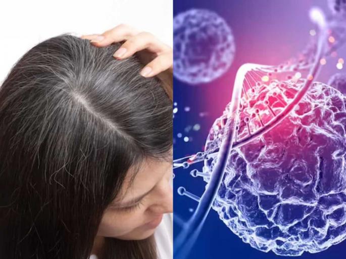 Grey hair could reveal more than ageing, studies link premature greying to oxidative stress and possible cancer risk | काय सांगता! पांढऱ्या केसांचा थेट कॅन्सरशी संबंध? तुमचेही केस कमी वयात पिकले असतील तर... Grey hair could reveal more than ageing, studies link premature greying to oxidative stress and possible cancer risk | काय सांगता! पांढऱ्या केसांचा थेट कॅन्सरशी संबंध? तुमचेही केस कमी वयात पिकले असतील तर...