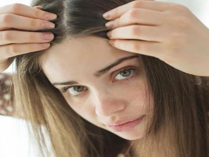 Hair suddenly turns white, why does it grey so prematurely? | केस अचानक खूप पांढरे व्हायला लागलेत, केस असे अकाली पिकतात कारण..