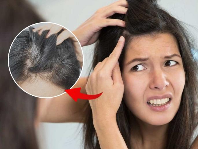 Grey hair at a young age, friends tease you about it? try this remedy | ऐन तारुण्यात केस पांढरे, मित्रमैत्रिणी आजीबाई म्हणून चिडवतात? हे घ्या उपाय-दिसा यंग आणि हॉट