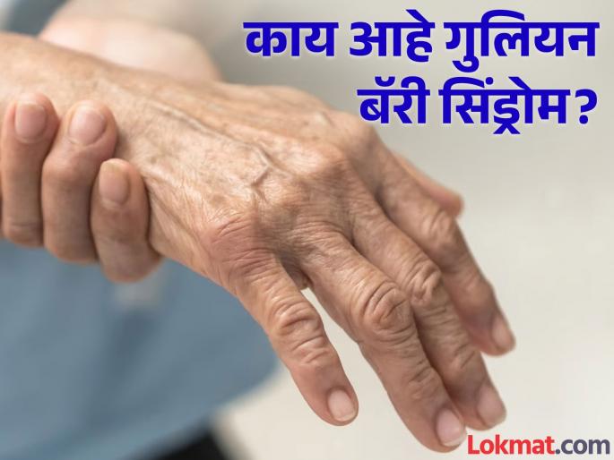 What is guillain barre syndrome know the causes symptoms and treatment | काय आहे गुलियन बॅरी सिंड्रोम आणि कोणती असतात या आजाराची लक्षणं? What is guillain barre syndrome know the causes symptoms and treatment | काय आहे गुलियन बॅरी सिंड्रोम आणि कोणती असतात या आजाराची लक्षणं?