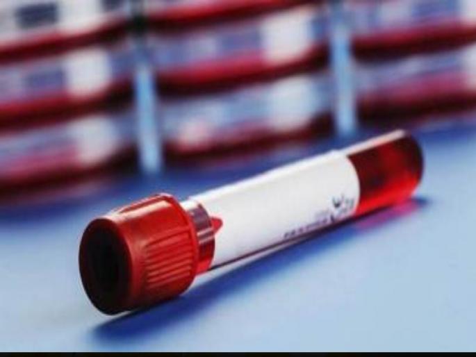 Congo fever enters Gujarat 51 year old man dies | गुजरातमध्ये काँगो फिवरची एन्ट्री; ५१ वर्षीय व्यक्तीचा मृत्यू, डॉक्टरांचा कुटुंबियांना सल्ला Congo fever enters Gujarat 51 year old man dies | गुजरातमध्ये काँगो फिवरची एन्ट्री; ५१ वर्षीय व्यक्तीचा मृत्यू, डॉक्टरांचा कुटुंबियांना सल्ला