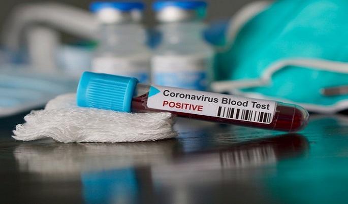 CoronaVirus in Akola: Two patients die in two days; 22 Positive | CoronaVirus in Akola : दोन दिवसांत दोघांचा मृत्यू; २२ पॉझिटिव्ह CoronaVirus in Akola: Two patients die in two days; 22 Positive | CoronaVirus in Akola : दोन दिवसांत दोघांचा मृत्यू; २२ पॉझिटिव्ह
