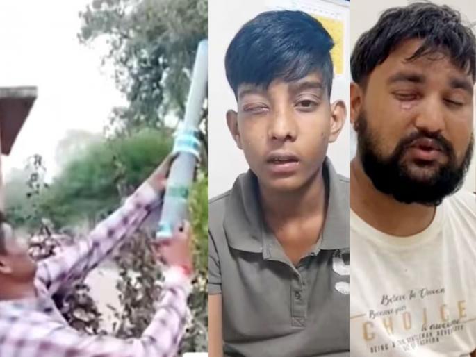 bhopal diwali tragedy calcium carbide gun injures children vision loss | Diwali Accident: क्षणात होत्याचं नव्हतं झालं! १५० रुपयांची कार्बाइड गन बेतली जीवावर, १२५ जणांनी गमावली दृष्टी bhopal diwali tragedy calcium carbide gun injures children vision loss | Diwali Accident: क्षणात होत्याचं नव्हतं झालं! १५० रुपयांची कार्बाइड गन बेतली जीवावर, १२५ जणांनी गमावली दृष्टी