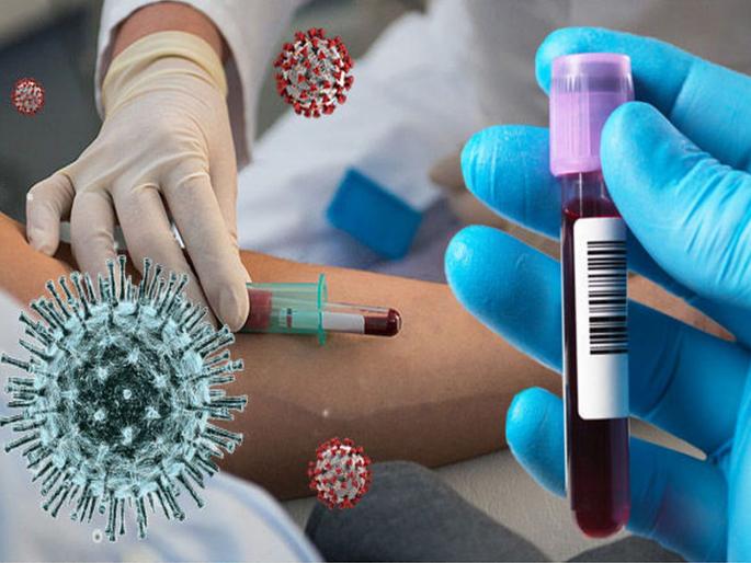 CoronaVirus Plasma therapy is not a full proof treatment; Center warns states hrb | CoronaVirus प्लाझ्मा थेरपी कोरोनावरचा उपचार नाही, आवरा; केंद्राचा राज्यांना इशारा CoronaVirus Plasma therapy is not a full proof treatment; Center warns states hrb | CoronaVirus प्लाझ्मा थेरपी कोरोनावरचा उपचार नाही, आवरा; केंद्राचा राज्यांना इशारा