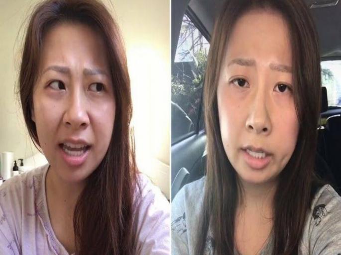 The Australian woman underwent tonsil operation, began speaking in the Irish cent | ऑस्ट्रेलियाची महिला, तोडांचे ऑप्रेशन केले आणि बोलू लागली आयरीश अॅसेंटमध्ये... The Australian woman underwent tonsil operation, began speaking in the Irish cent | ऑस्ट्रेलियाची महिला, तोडांचे ऑप्रेशन केले आणि बोलू लागली आयरीश अॅसेंटमध्ये...