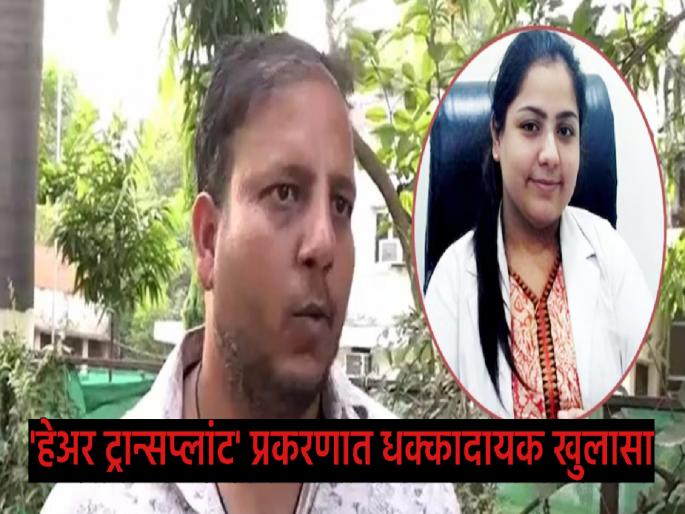 Not Anushka Tiwari, but children like craftsmen were performing 'hair transplant' surgeries | अनुष्का तिवारी नाही, कारागिरांसारखी मुलं करत होती शस्त्रक्रिया! 'हेअर ट्रान्सप्लांट' प्रकरणात धक्कादायक खुलासा Not Anushka Tiwari, but children like craftsmen were performing 'hair transplant' surgeries | अनुष्का तिवारी नाही, कारागिरांसारखी मुलं करत होती शस्त्रक्रिया! 'हेअर ट्रान्सप्लांट' प्रकरणात धक्कादायक खुलासा