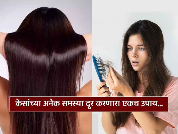 Apply vitamin e, onion juice and coconut oil on hair to get rid off hair fall, dandruff | केसगळती थांबेल, कोंडाही कमी अन् केसही वाढतील; आठवड्यातून एकदा करा हा नॅचरल उपाय!