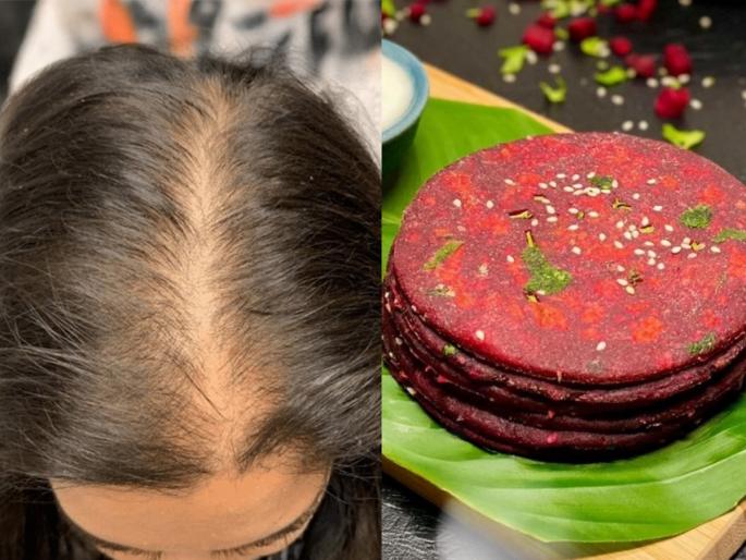 Best Beetroot Chila For Hair Fall Control : Beetroot Chila Recipe For Hair Fall Control | कपाळावर टक्कल दिसतं? बीट-आवळ्याचा डोसा खा; दाट-लांब होतील केस-पाहा सोपी रेसिपी