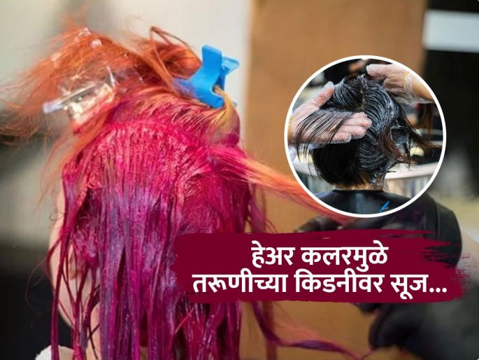 20 Years Old Woman Gets Kidney Disease After Dyeing Hair Monthly To Match Pop Idol | सतत हेअर कलर करणं तरूणीला पडलं महागात, झाला किडनीसंबंधी आजार; पाहा काय काळजी घ्याल