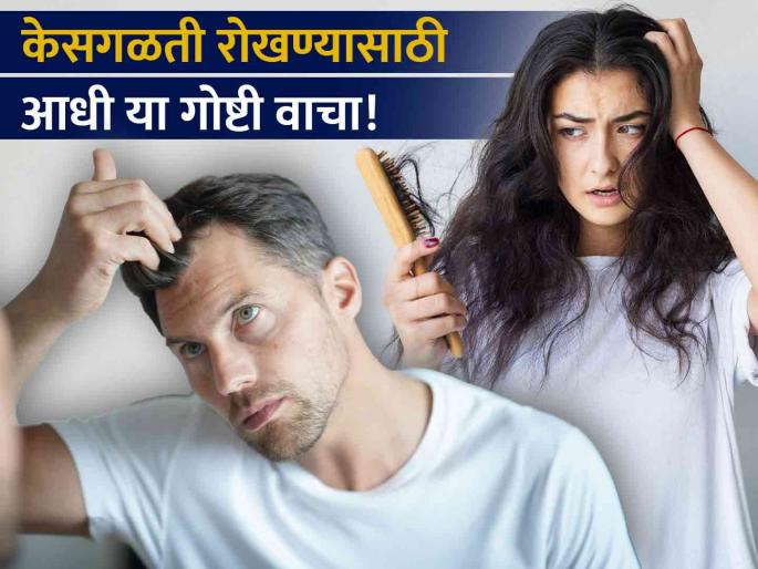 Doctor tells the common reasons of hair fall | केसगळतीबाबत डॉक्टरांनी सांगितल्या महत्वाच्या गोष्टी, जाणून घ्या केसगळतीची कारणे Doctor tells the common reasons of hair fall | केसगळतीबाबत डॉक्टरांनी सांगितल्या महत्वाच्या गोष्टी, जाणून घ्या केसगळतीची कारणे