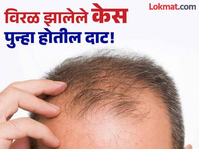 Use these home remedies for make hair growth superfast | डोक्यावर पुन्हा केस उगवण्यासाठी ट्राय करा हे नॅचरल उपाय, टोपी घालून फिरणं होईल बंद!