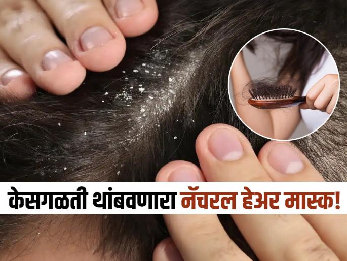 Javed Habib tells remedy for stop hair fall and clean dandruff | केसगळतीही थांबेल आणि कोंडाही होईल दूर, जावेद हबीबनं सांगितला एक खास हेअर मास्क!