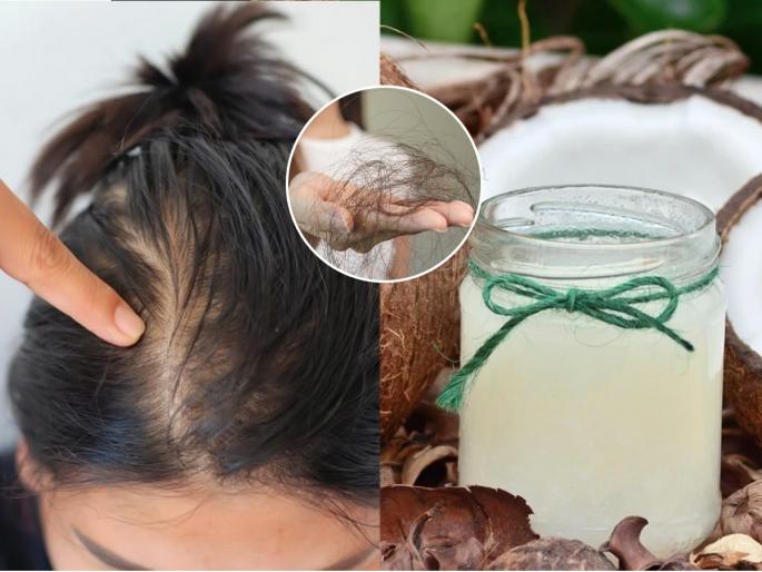 Best hair oil for winter Best oil for dry hair in winter Best oil for hair fall in winter Hair oil for frizzy hair in winter | हिवाळ्यात केस खराट्यासारखे रखरखीत होऊन गळत असतील तर लावा ३ तेल, थंडीत तुमचे केस होतील रेशमी...