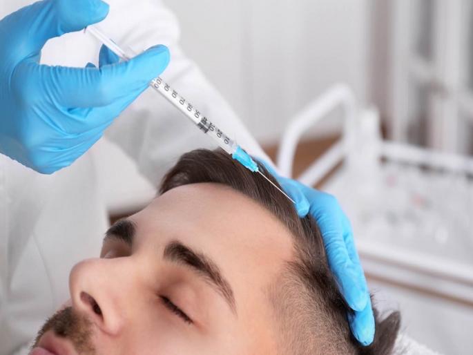 doctor 300 hair transplants medical professionals without any degree | वेगळीच 'केस'; कोणतीही पदवी नसताना पुण्यातील तोतया डॉक्टरने केल्या 300 हेअर ट्रान्सप्लांट doctor 300 hair transplants medical professionals without any degree | वेगळीच 'केस'; कोणतीही पदवी नसताना पुण्यातील तोतया डॉक्टरने केल्या 300 हेअर ट्रान्सप्लांट
