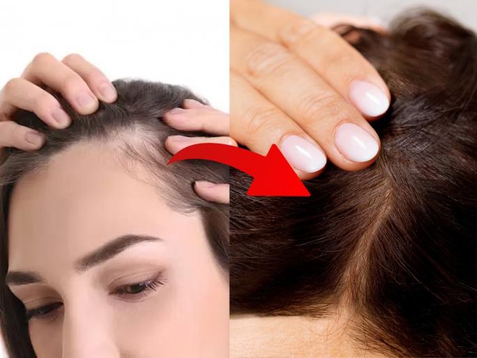Forehead looks so big that it looks like baldness, do 4 hairstyles - you will look beautiful every day, haircare tips | कपाळ इतकं मोठ्ठं दिसतं की जणू टक्कलच, करा ४ हेअरस्टाईल-रोज सुंदर दिसाल