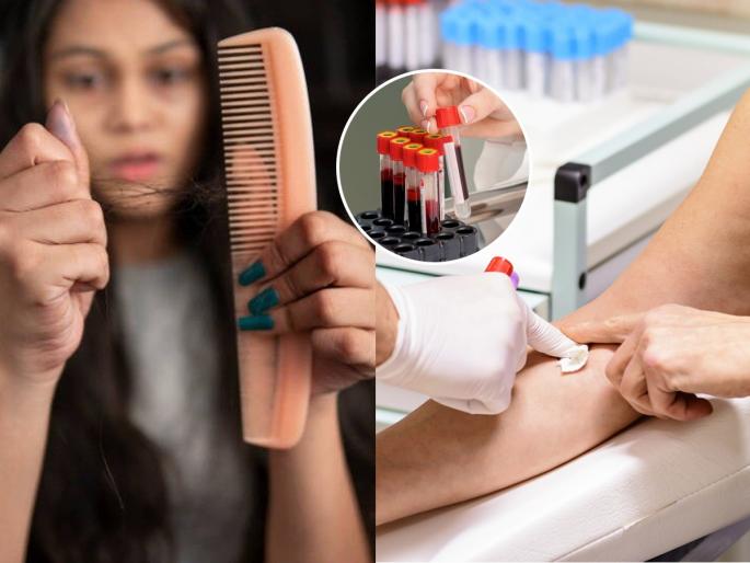 reasons for hair loss in women blood test for hair thinning doctor recommended tests for hair loss | सगळे उपाय केले तरी केसगळती थांबत नाही? ६ उपाय - डॉक्टरांचा सल्ला, केस होतील दाट-लांब