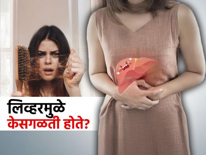 Liver health can cause of hairfall content creator tells 3 spices for detox liver good hair health | पोषण कमी असणंच नाही तर लिव्हरही ठरतं केसगळतीचं कारण, 'ही' एक चूक टाळा; केसगळती थांबवा...