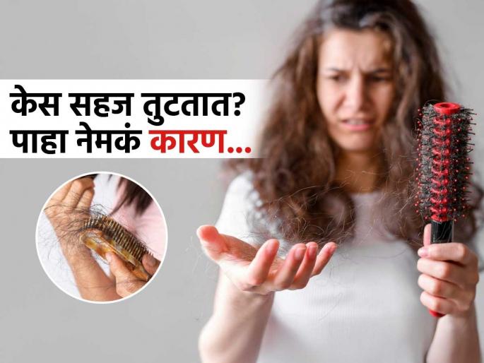 Which vitamin deficiency causes for hair loss | हात लावताच तुटतात-गळतात केस? पाहा कोणत्या व्हिटामिन्सच्या कमतरतेने पडू शकतं टक्कल Which vitamin deficiency causes for hair loss | हात लावताच तुटतात-गळतात केस? पाहा कोणत्या व्हिटामिन्सच्या कमतरतेने पडू शकतं टक्कल