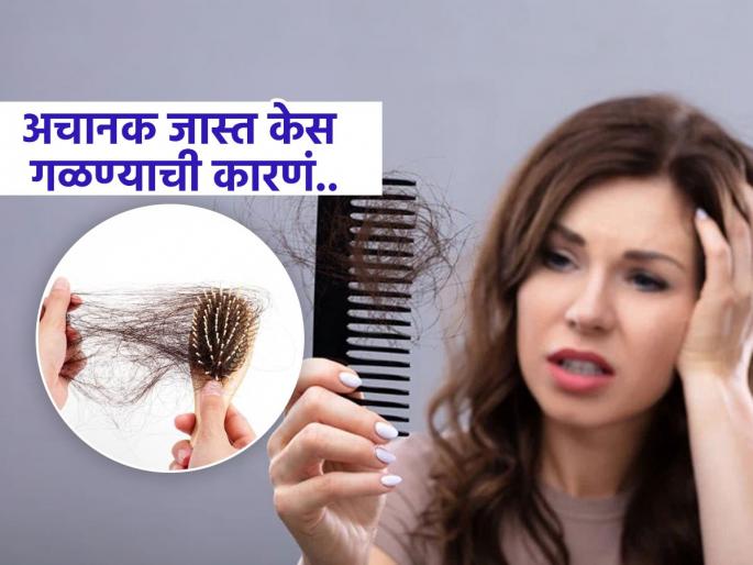 Excessive hair breakage and hair loss occurs, see what disease it is a sign of | अचानक जास्त प्रमाणात तुटतात - गळतात केस, पाहा कोणत्या आजाराचे आहे हे संकेत Excessive hair breakage and hair loss occurs, see what disease it is a sign of | अचानक जास्त प्रमाणात तुटतात - गळतात केस, पाहा कोणत्या आजाराचे आहे हे संकेत