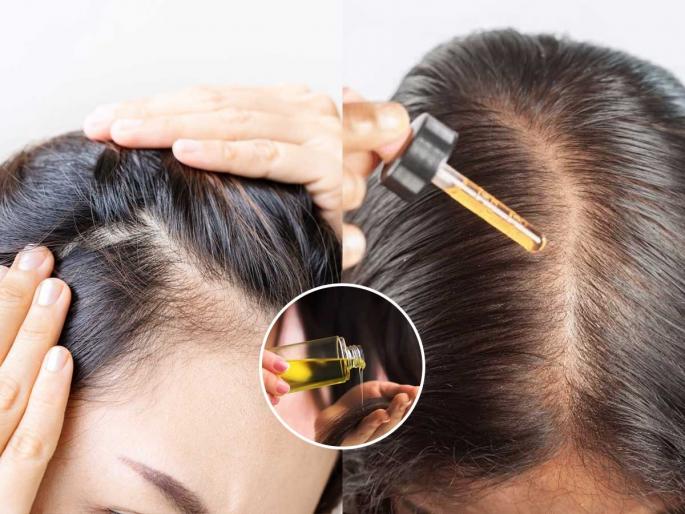 how many times a week should you oil your hair can applying oil cause hair fall common hair oiling mistakes that cause baldness best hair oiling routine to reduce hair fall how to apply oil properly on scalp | चुकीच्या पद्धतीने केसांना तेल लावल्यास पडते टक्कल, आठवड्यातून 'इतक्या' वेळा लावा; केसगळती होईल कमी how many times a week should you oil your hair can applying oil cause hair fall common hair oiling mistakes that cause baldness best hair oiling routine to reduce hair fall how to apply oil properly on scalp | चुकीच्या पद्धतीने केसांना तेल लावल्यास पडते टक्कल, आठवड्यातून 'इतक्या' वेळा लावा; केसगळती होईल कमी